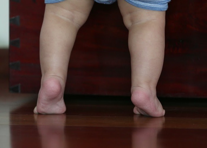 Why do some Autistic Children Walk on Tip Toes